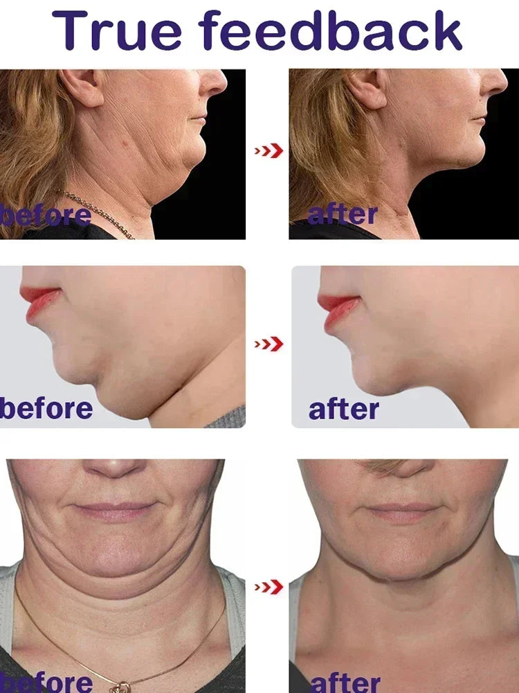 Double Chin Remover – Face Slimming Tool