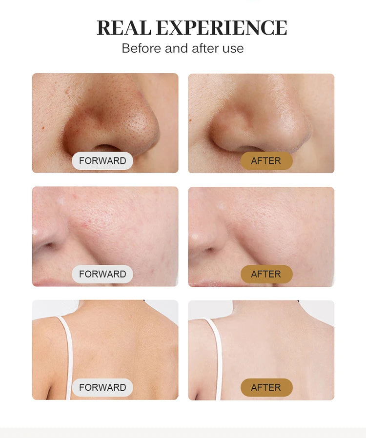 2025 Professional Skin Whitening Rejuvenation Facial Beauty Machines Diamond Dermabrasion Acne Treatment Oxygen Bubble Machine
