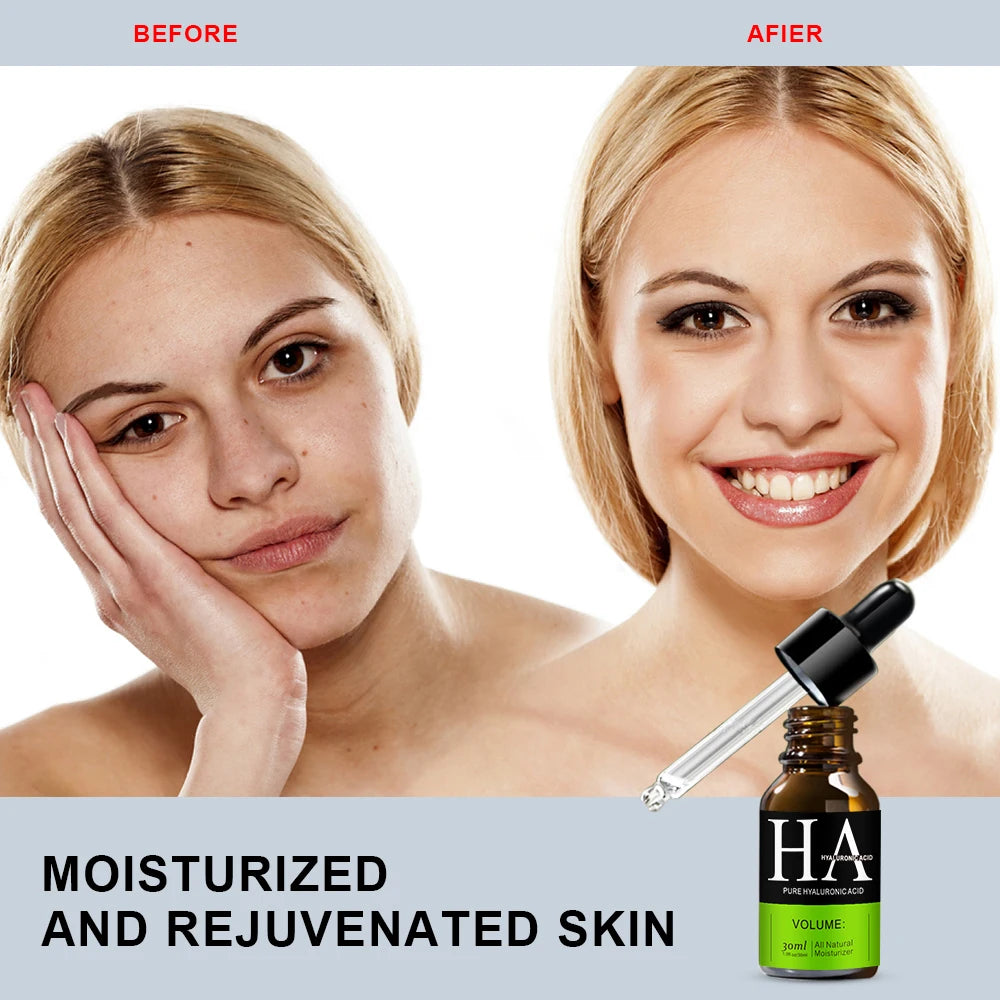Vitamin C Retinol Face Serum – Anti-Aging & Whitening