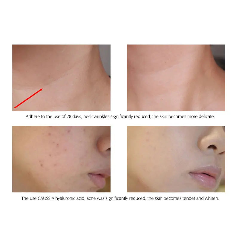 ARTISCARE Hyaluronic Acid Serum – Hydrating Essence (10pcs)