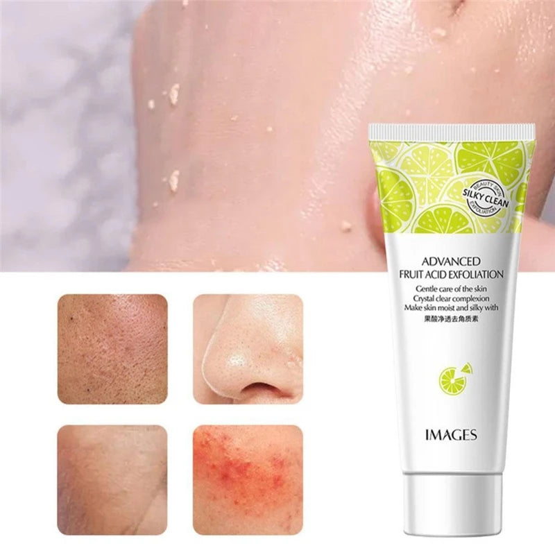 Fruit Acid Peeling Gel – Exfoliating & Blackhead Removal