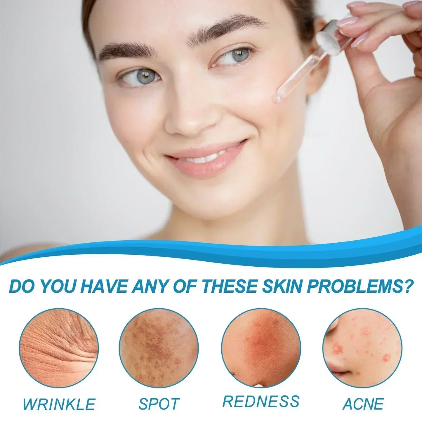 Facial Skin Peel Serum – Chemical Peel for Acne & Wrinkles