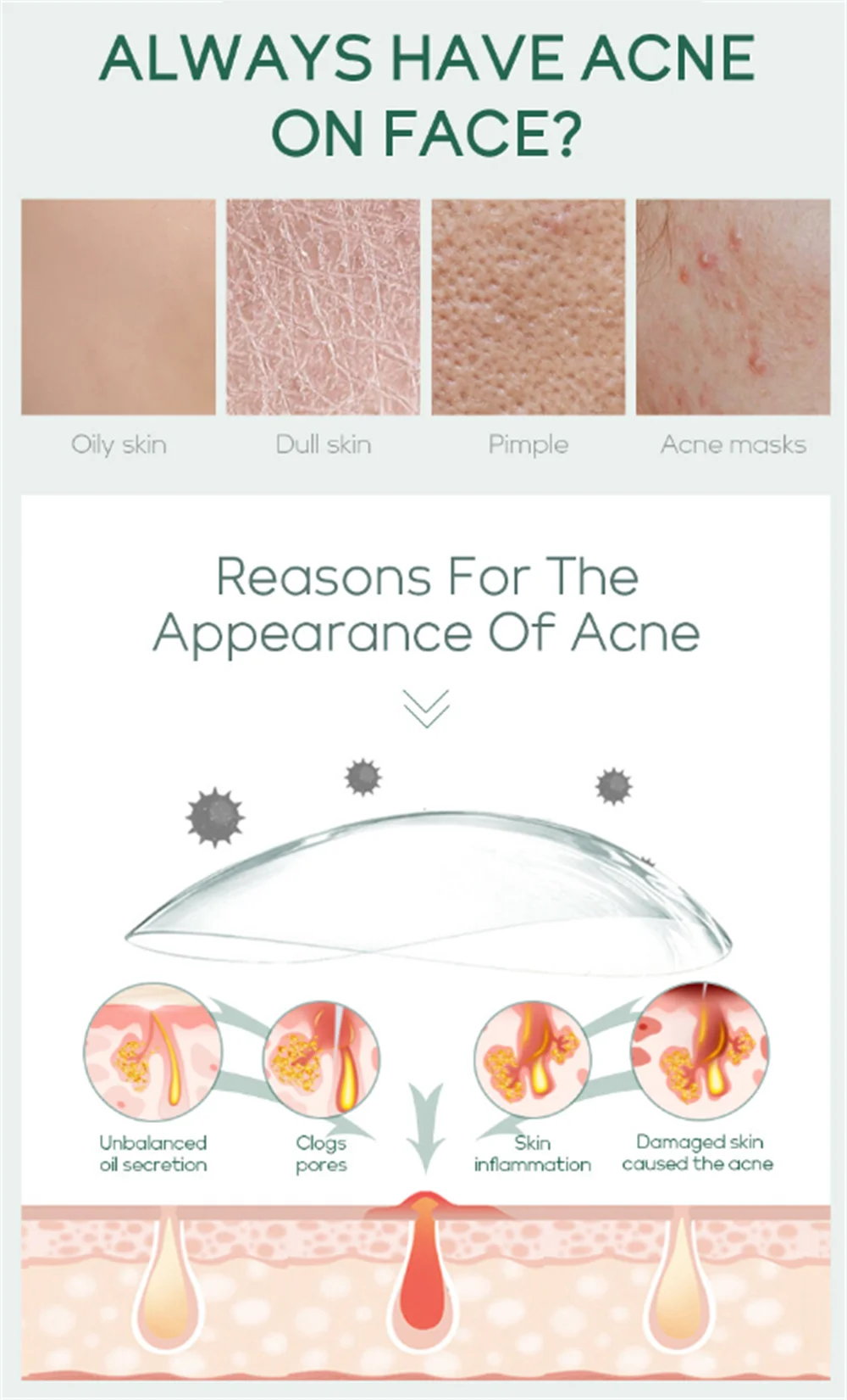 Salicylic Acid Acne Serum – Pore & Oil Control Treatment