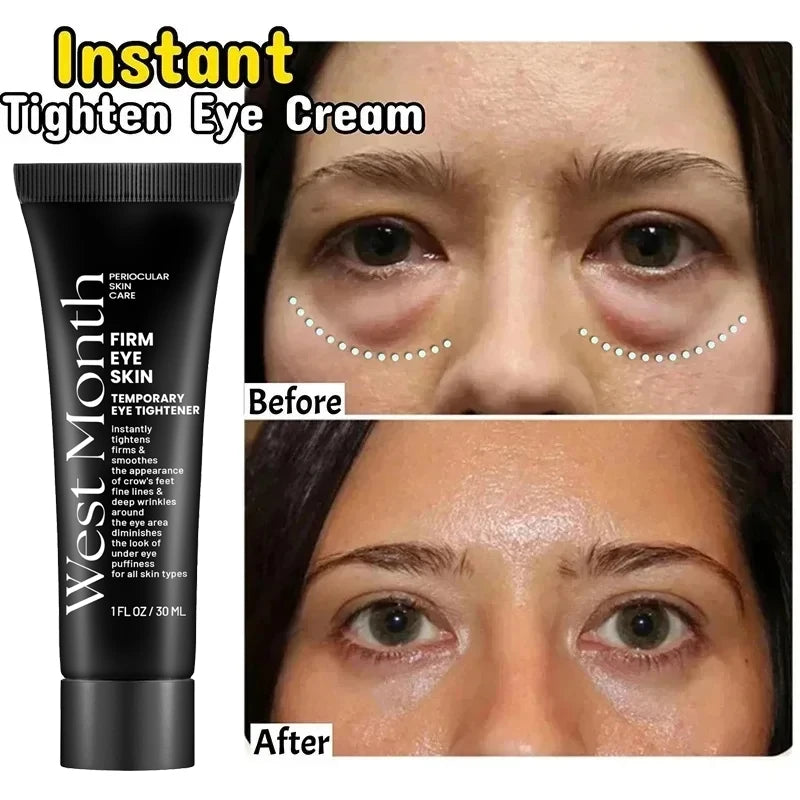 Eye Bag Removal Cream – Anti-Puffiness & Firming