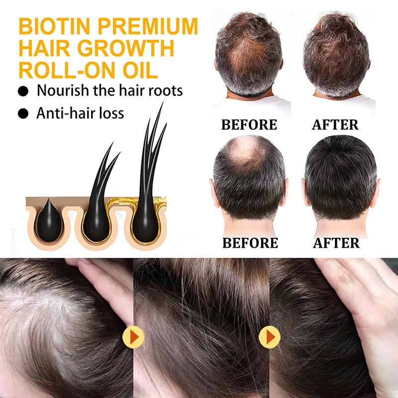 Biotin Hair Growth Shampoo – Anti-Hair Loss Treatment
