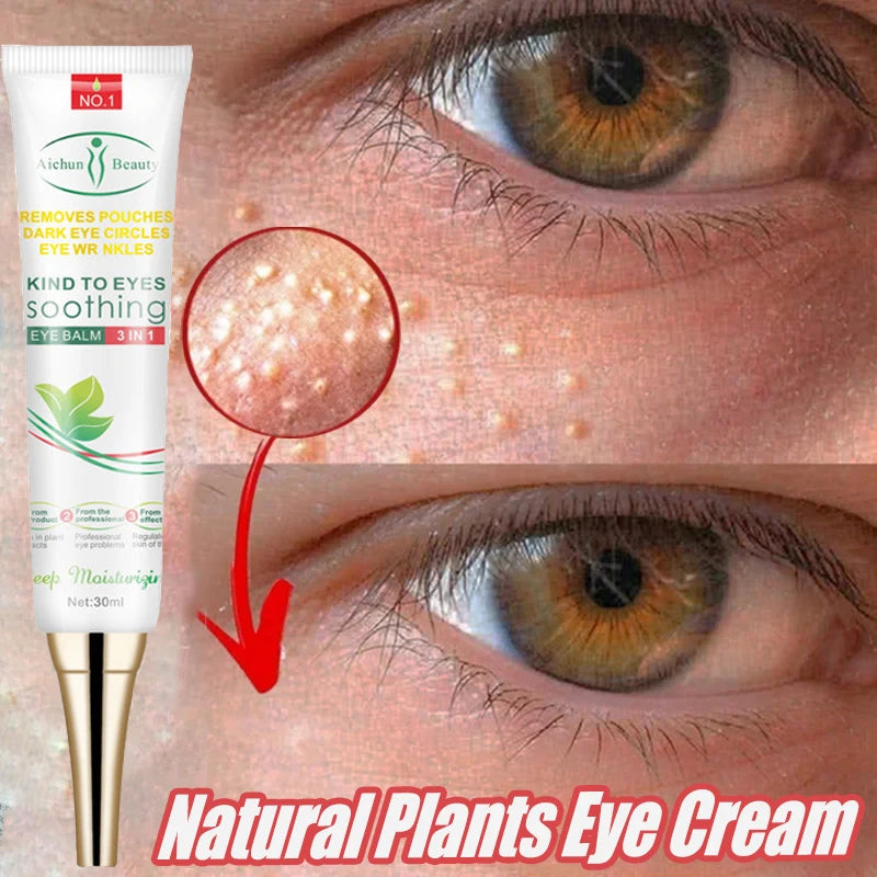 Fat Granules Remover Eye Cream – Anti-Wrinkle & Firming