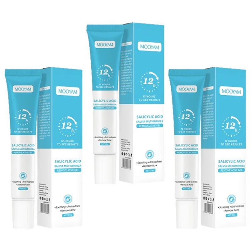 Acne Face Cream – Pimple Treatment & Oil Control Care