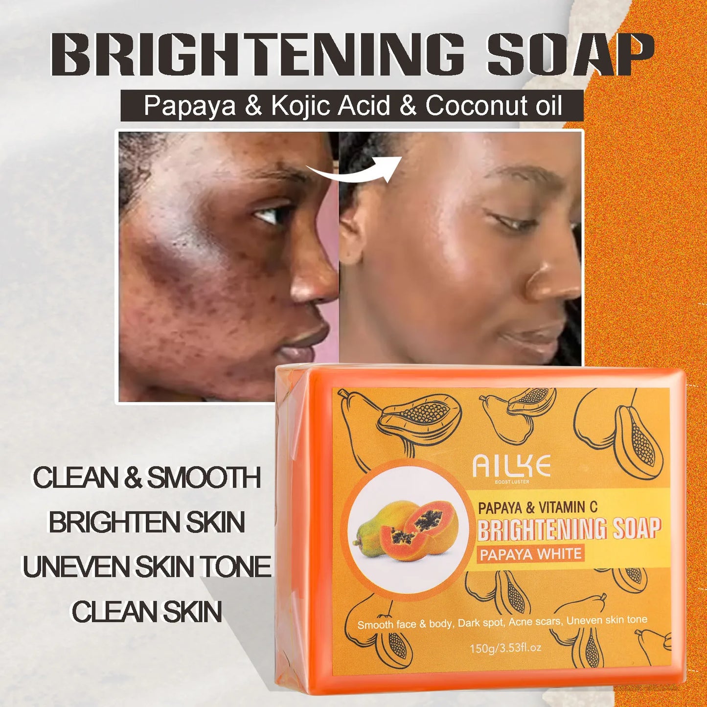 AILKE Bleaching Cream – Dark Spot Remover for Body & Face