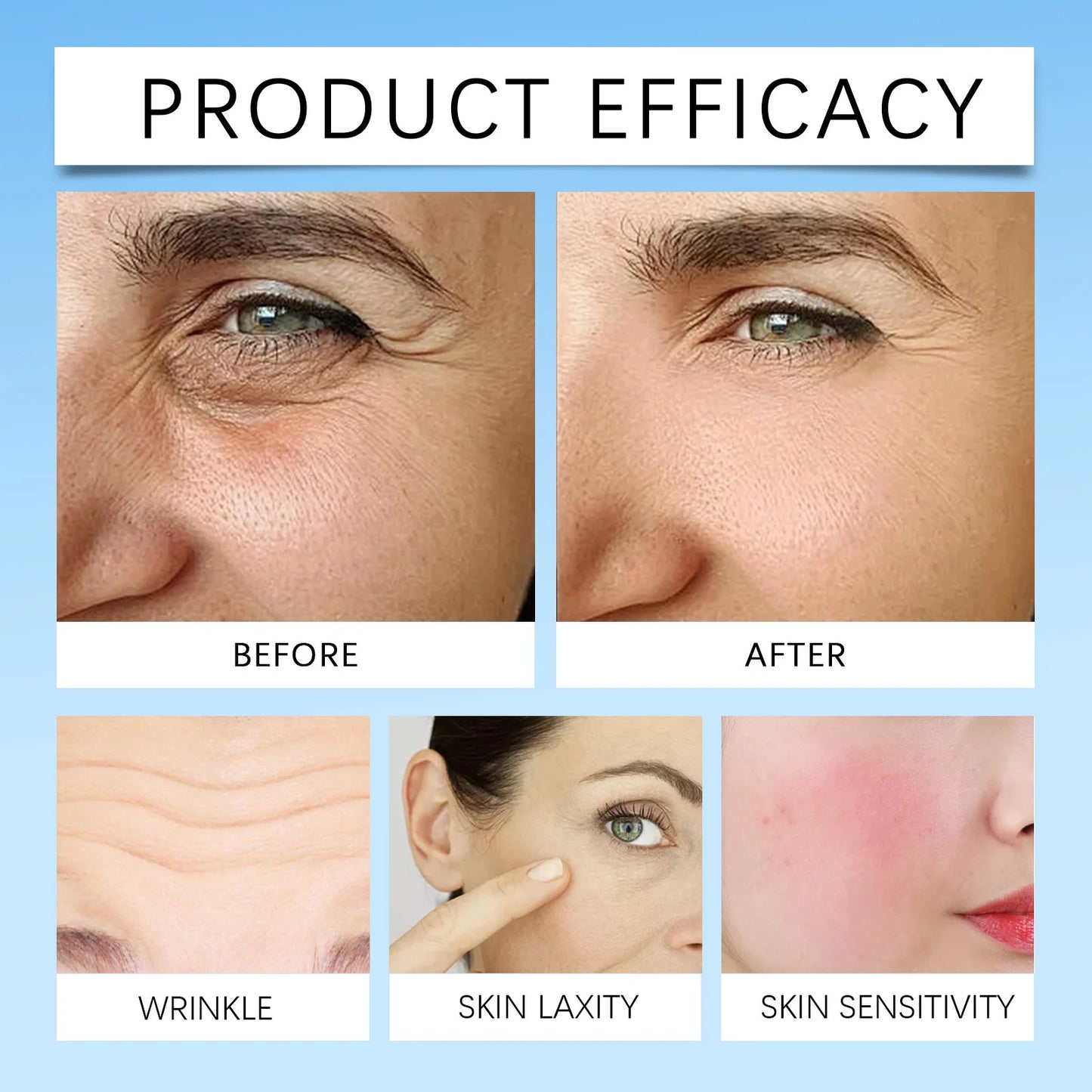 Retinol Wrinkle Remover Face Serum – Anti-Aging & Lifting