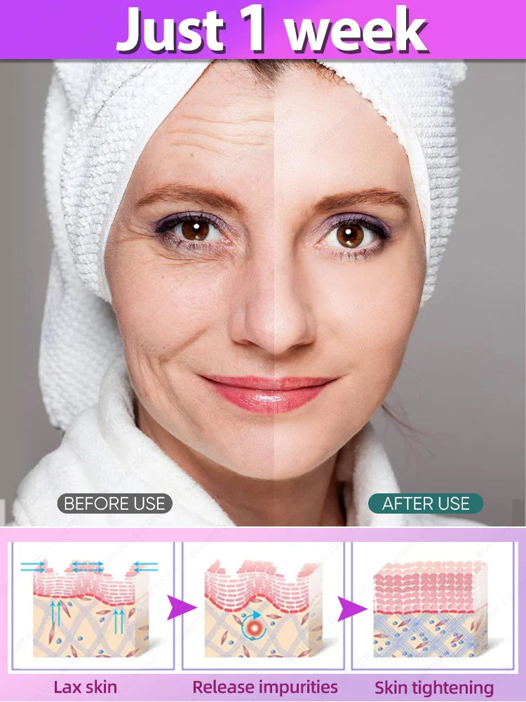 Wrinkle Removal Serum – Anti-Aging Face Lifting