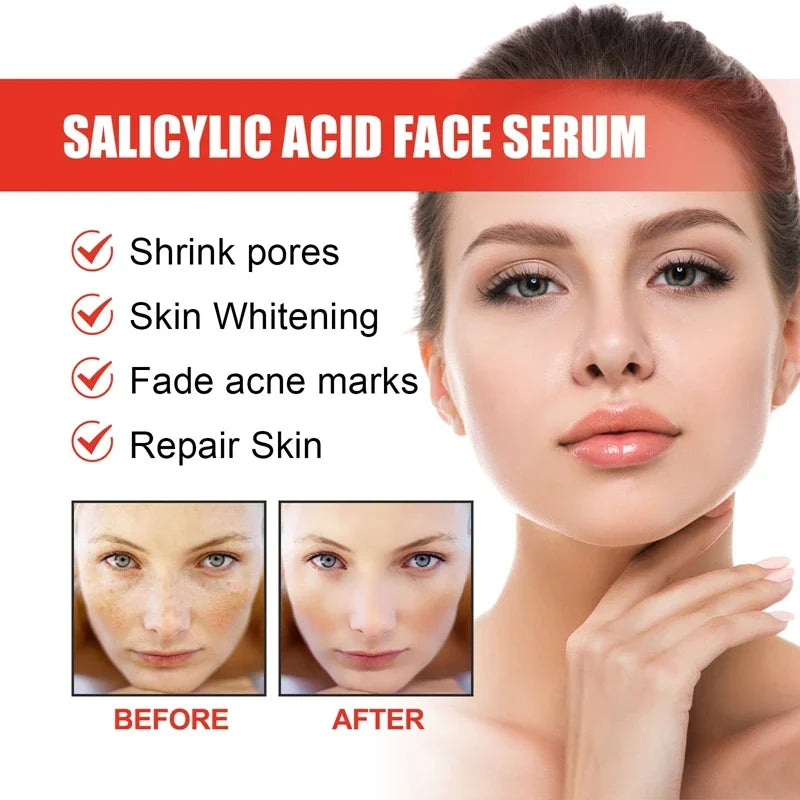 Niacinamide & Salicylic Acid Serum – Sensitive Skin Repair