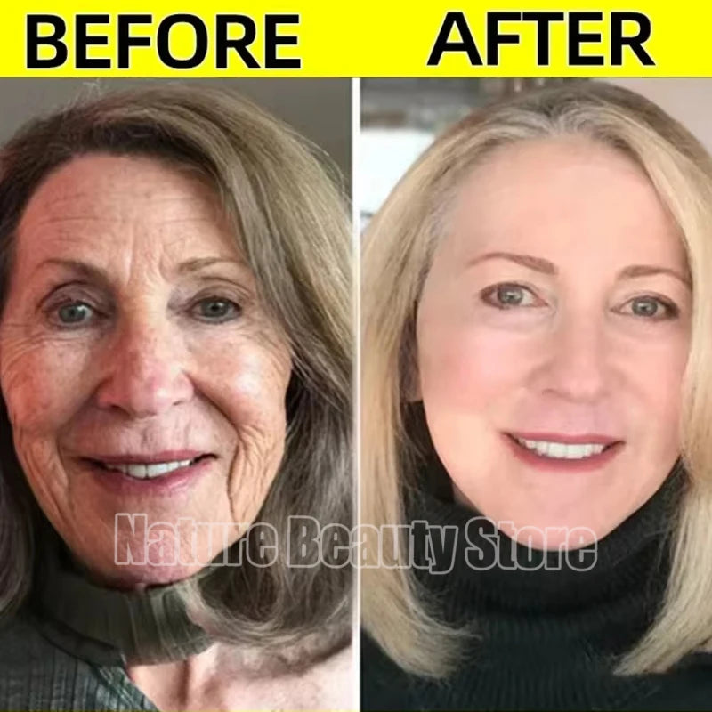 Retinol Wrinkle Remover Face Serum – Anti-Aging & Lifting