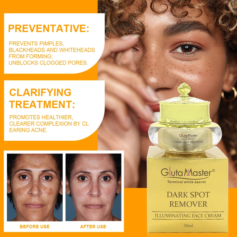 Gluta Maste Dark Spot Cream – Pore Minimizer & Anti-Acne Brightening
