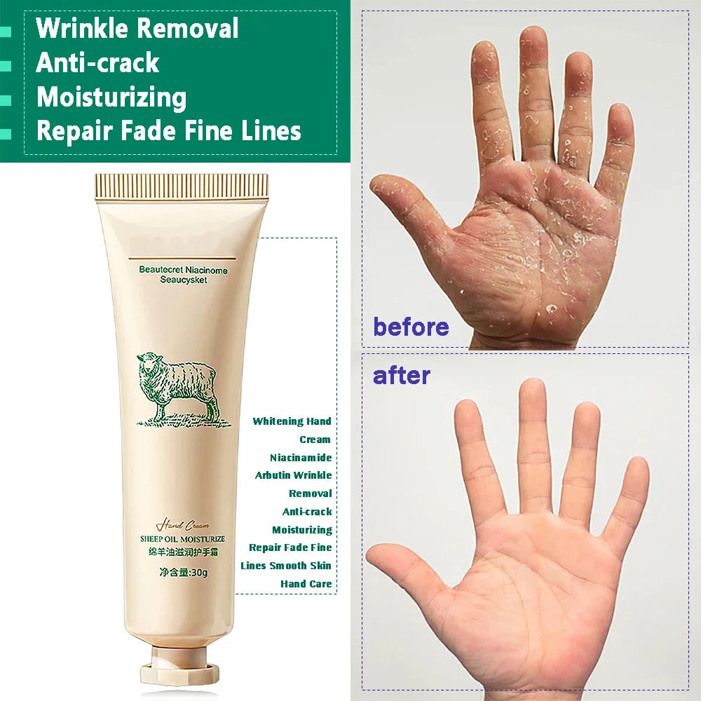 Collagen Hand Cream – Soften & Repair Dry Skin