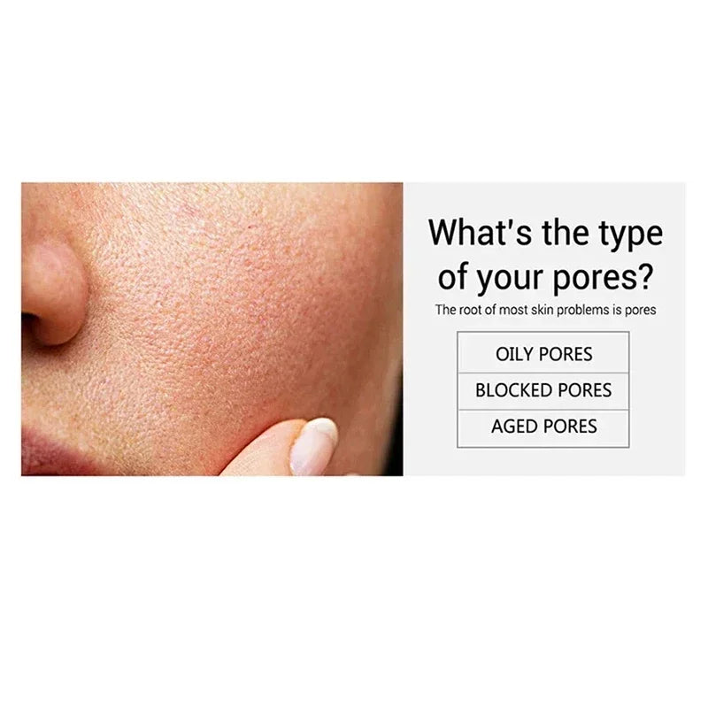 Salicylic Acid Pore Cream – Blackhead & Skin Repair Care