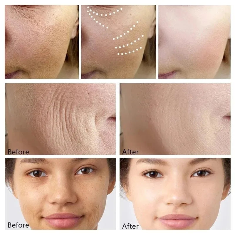 Retinol Face Cream – Korean Anti-Aging Skincare