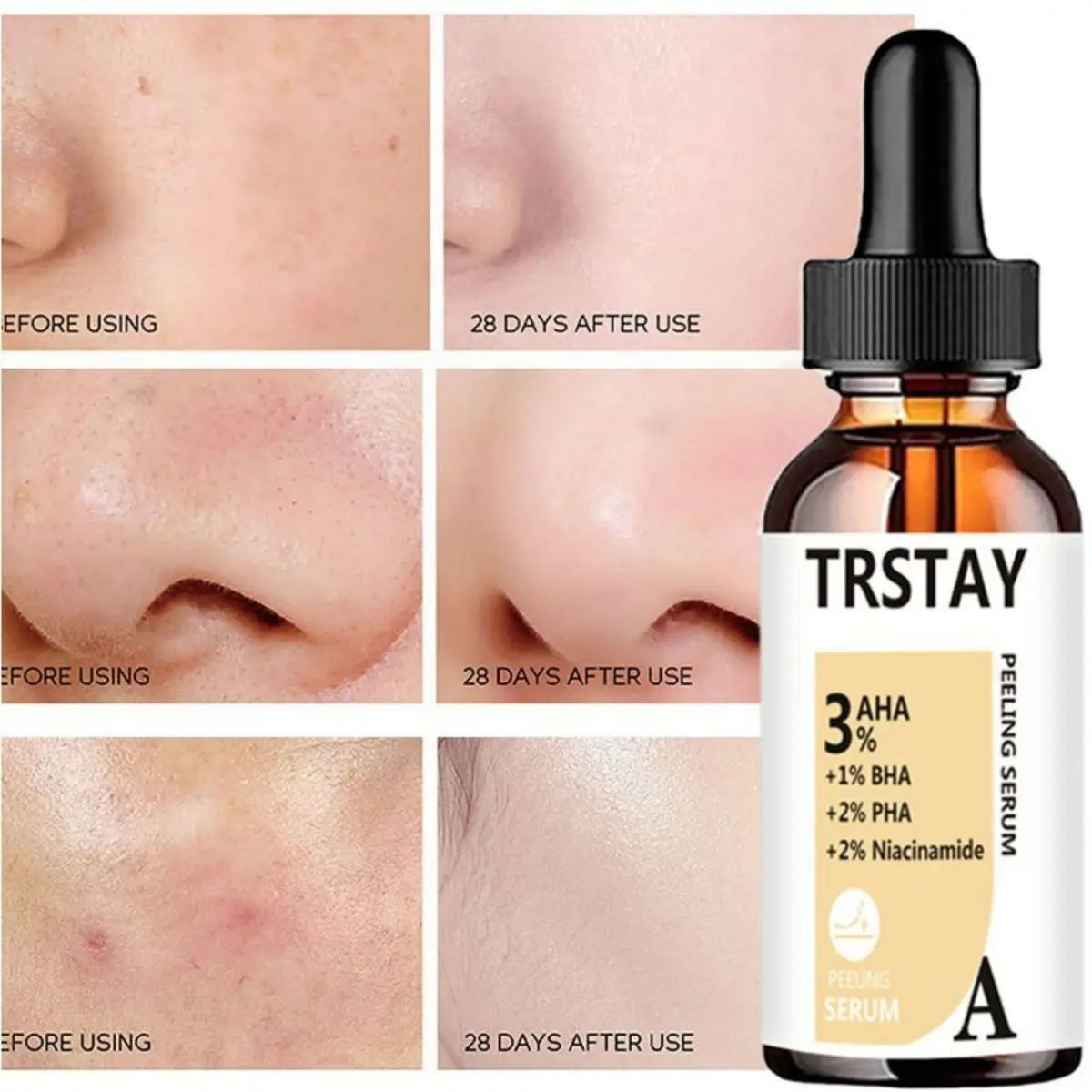 AHA Peeling Serum – Salicylic Acid Acne & Pore Treatment