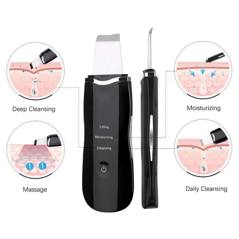Ultrasonic Facial Cleaner – Blackhead & Peeling Device