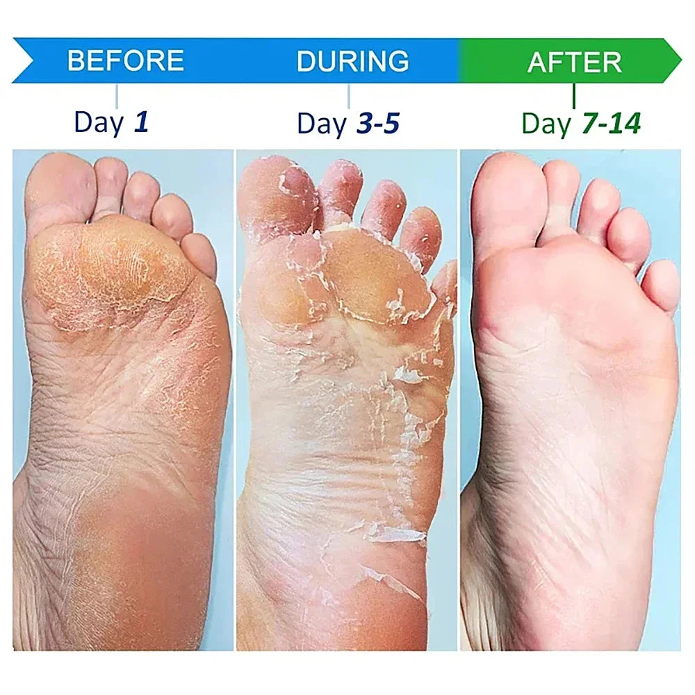 Collagen Hand Cream – Soften & Repair Dry Skin