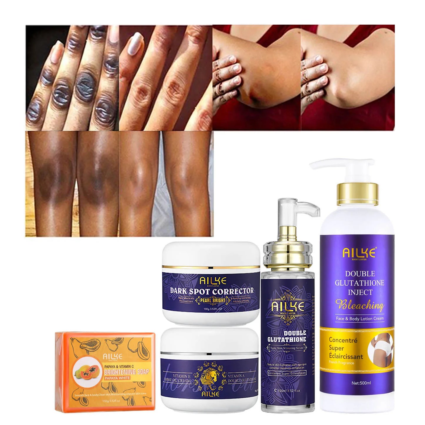 AILKE Glutathione 5-in-1 Skincare Kit – Lotion, Serum & Soap