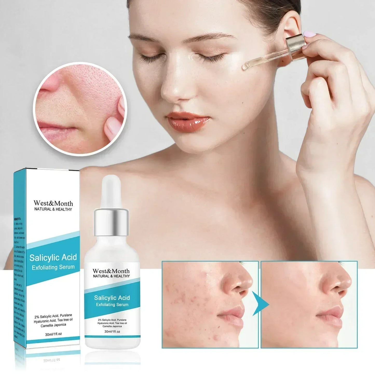 Facial Skin Peel Serum – Chemical Peel for Acne & Wrinkles