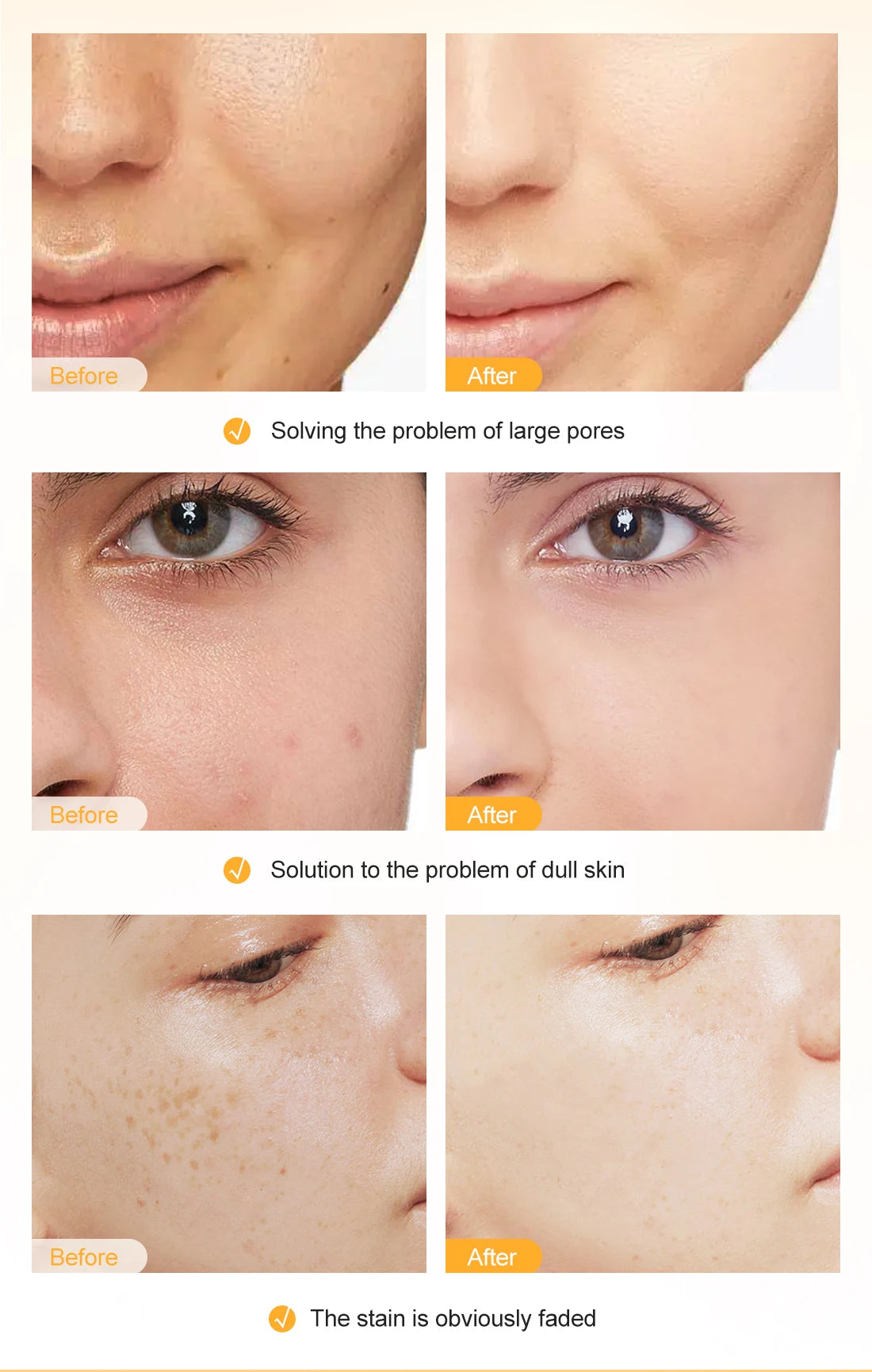 RtopR Vitamin C Whitening Serum – Brightening & Moisturizing