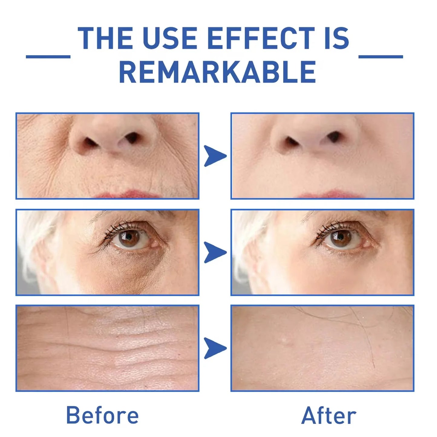 Retinol Wrinkle Remover Face Serum – Anti-Aging & Lifting