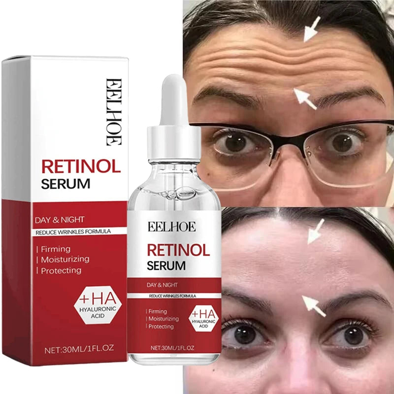 Retinol & Collagen Face Cream – Anti-Aging Wrinkle Remover