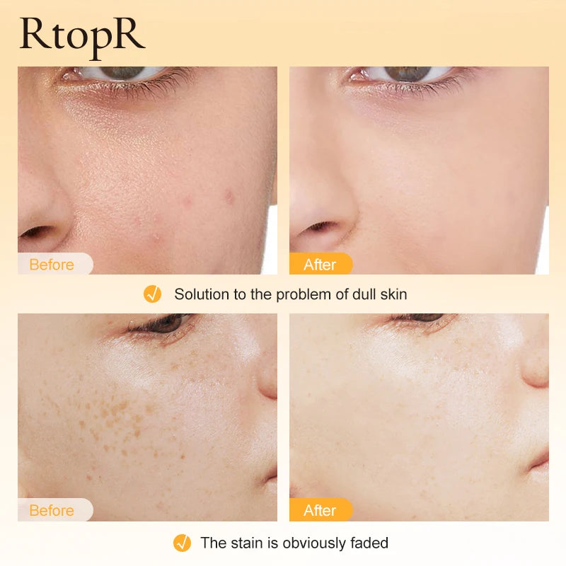 RtopR Vitamin C Whitening Serum – Brightening & Moisturizing
