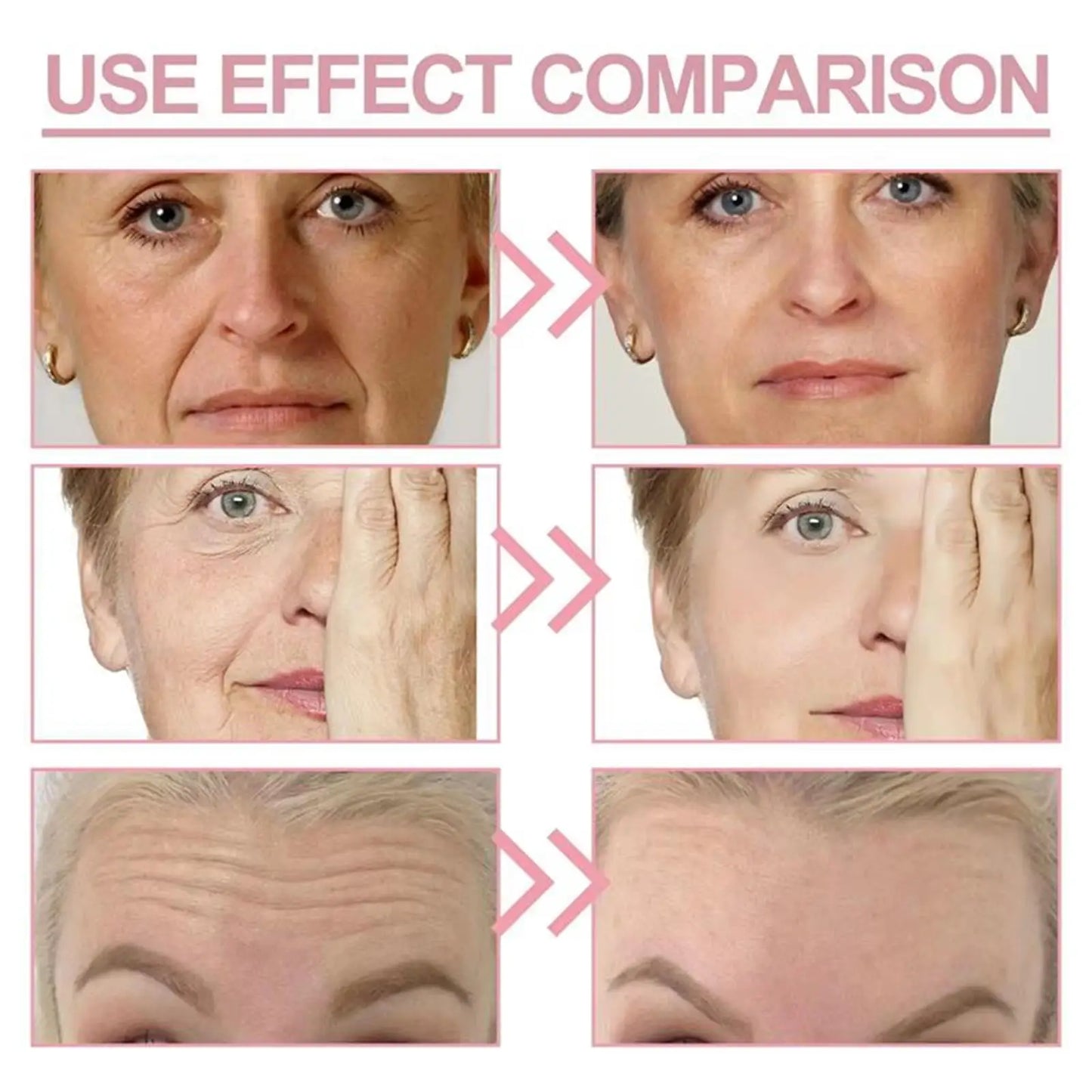 Instant Wrinkle Removal Balm – Collagen Anti-Aging Cream