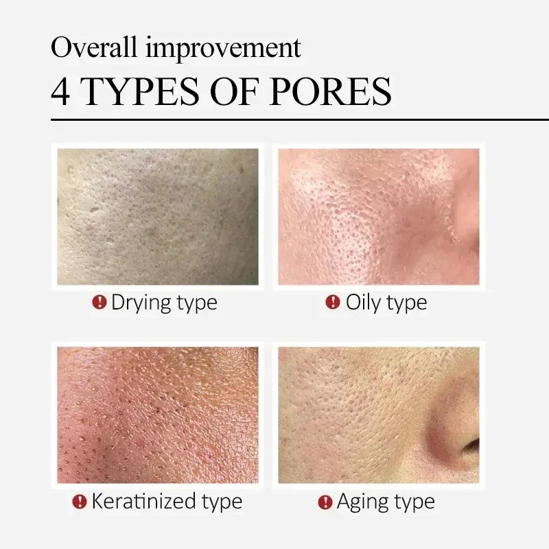 Salicylic Acid Pore Cream – Blackhead & Skin Repair Care