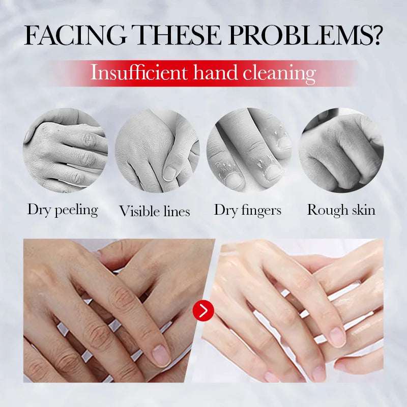 Kojic Acid Hand & Body Cream – Brightening & Moisturizing