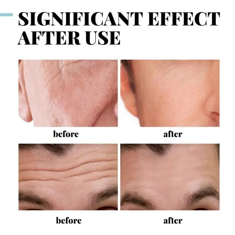 Men’s Collagen Cream – Anti-Wrinkle & Moisturizing