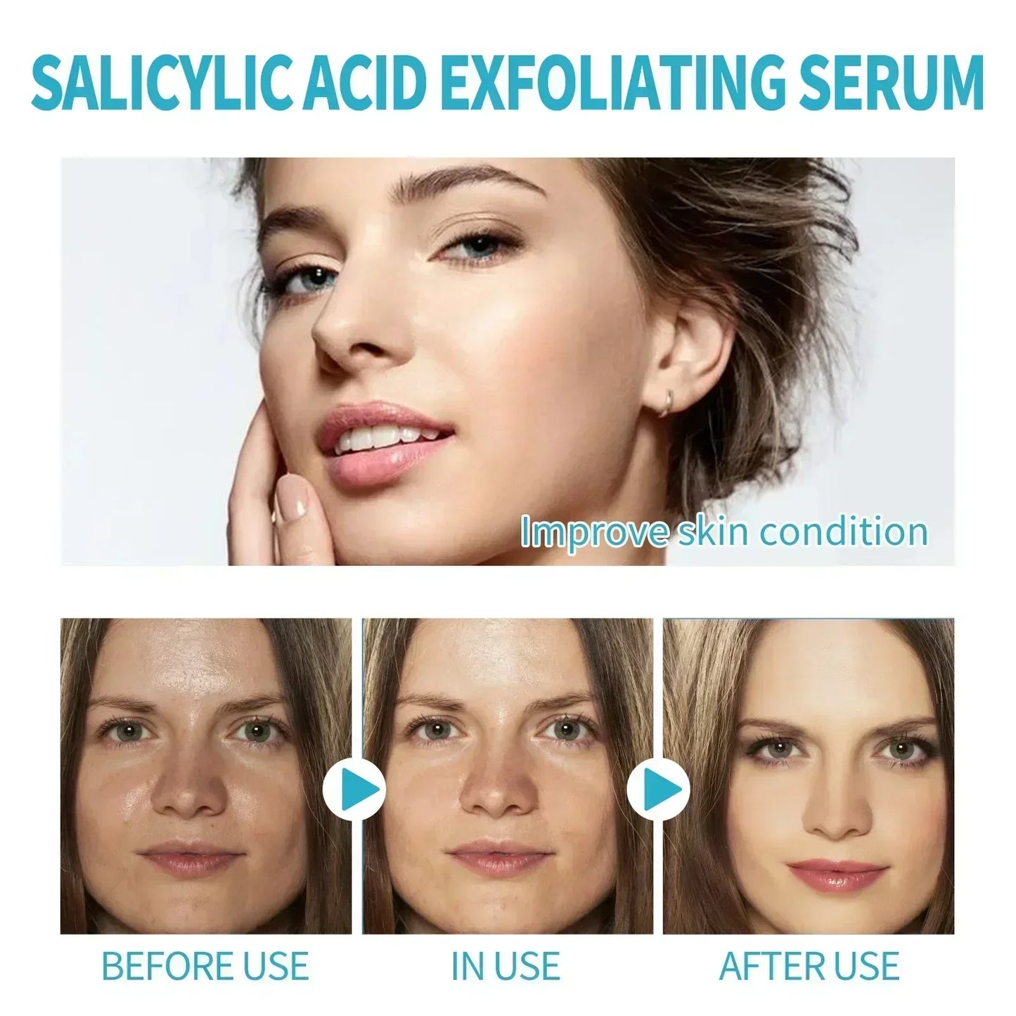 Facial Skin Peel Serum – Chemical Peel for Acne & Wrinkles