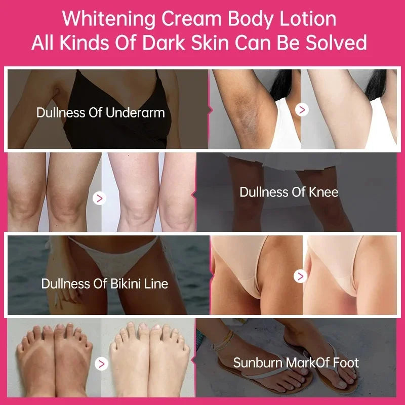 Body Whitening Cream – Intimate & Dark Spot Brightening Lotion