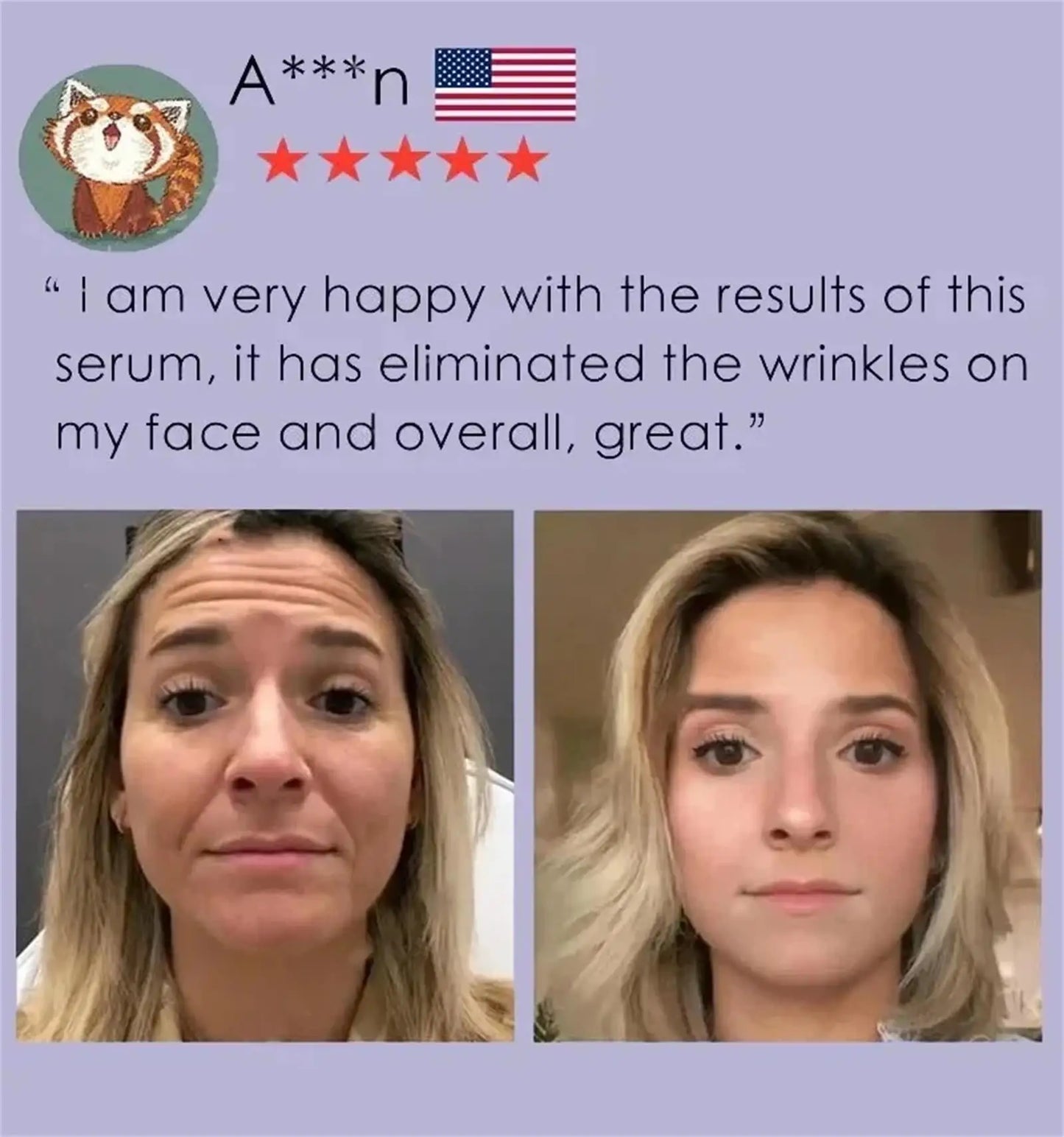 Retinol Wrinkle Remover Face Serum – Anti-Aging & Lifting