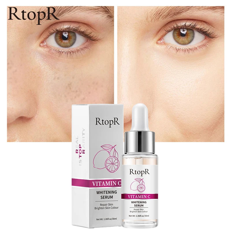 RtopR Vitamin C Whitening Serum – Brightening & Moisturizing