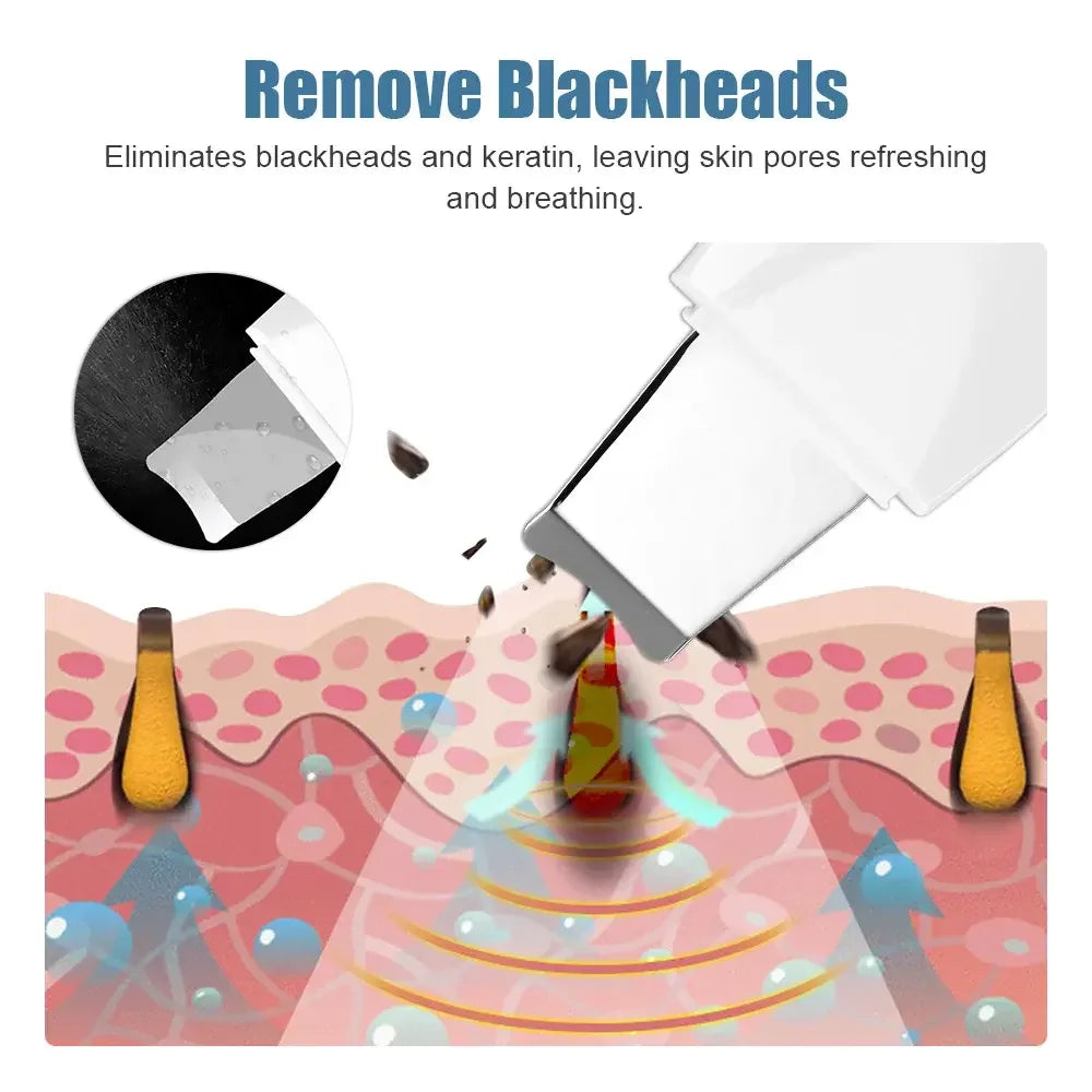 Ultrasonic Skin Scrubber – Deep Pore Cleansing Tool