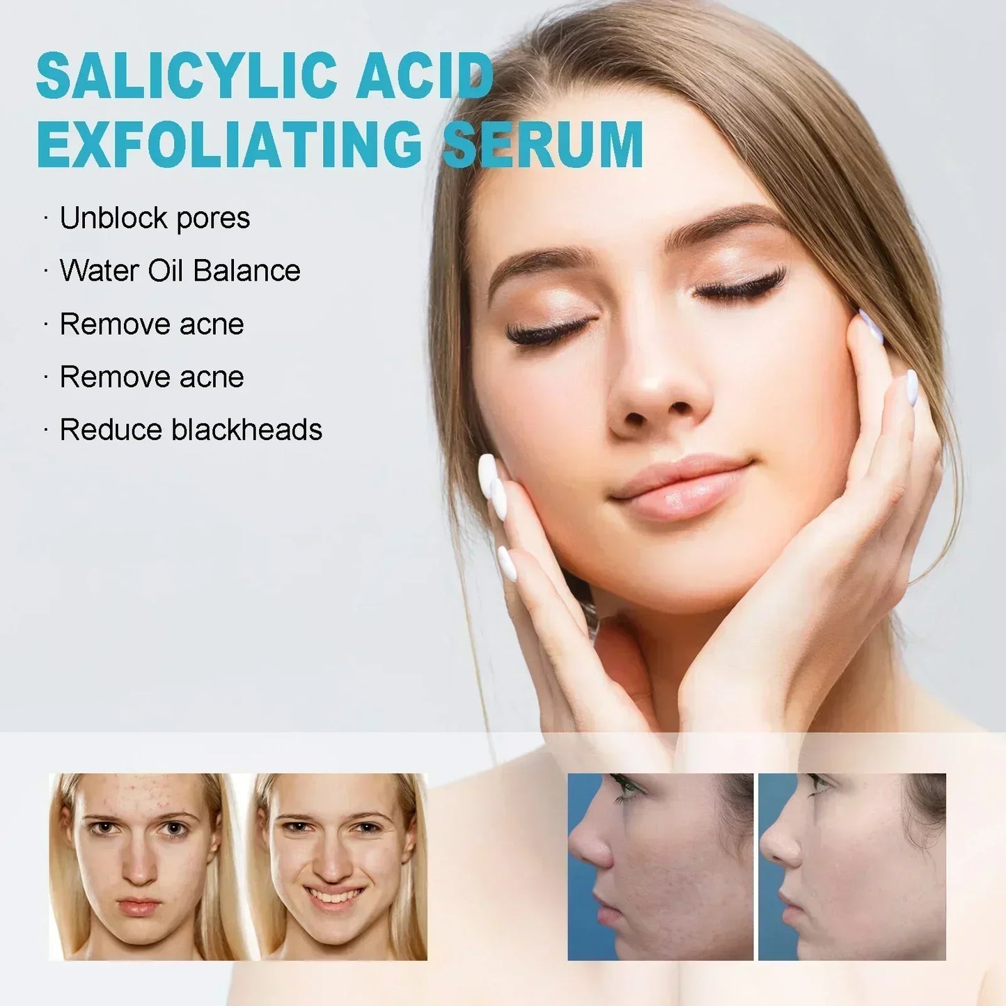 Facial Skin Peel Serum – Chemical Peel for Acne & Wrinkles