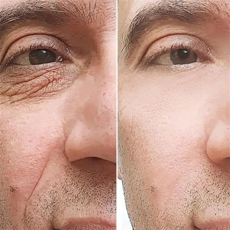 Retinol Anti-Wrinkle Cream – Men’s Collagen Face & Neck Care