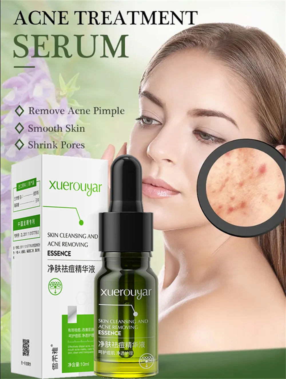 Salicylic Acid Acne Serum – Pore & Oil Control Treatment