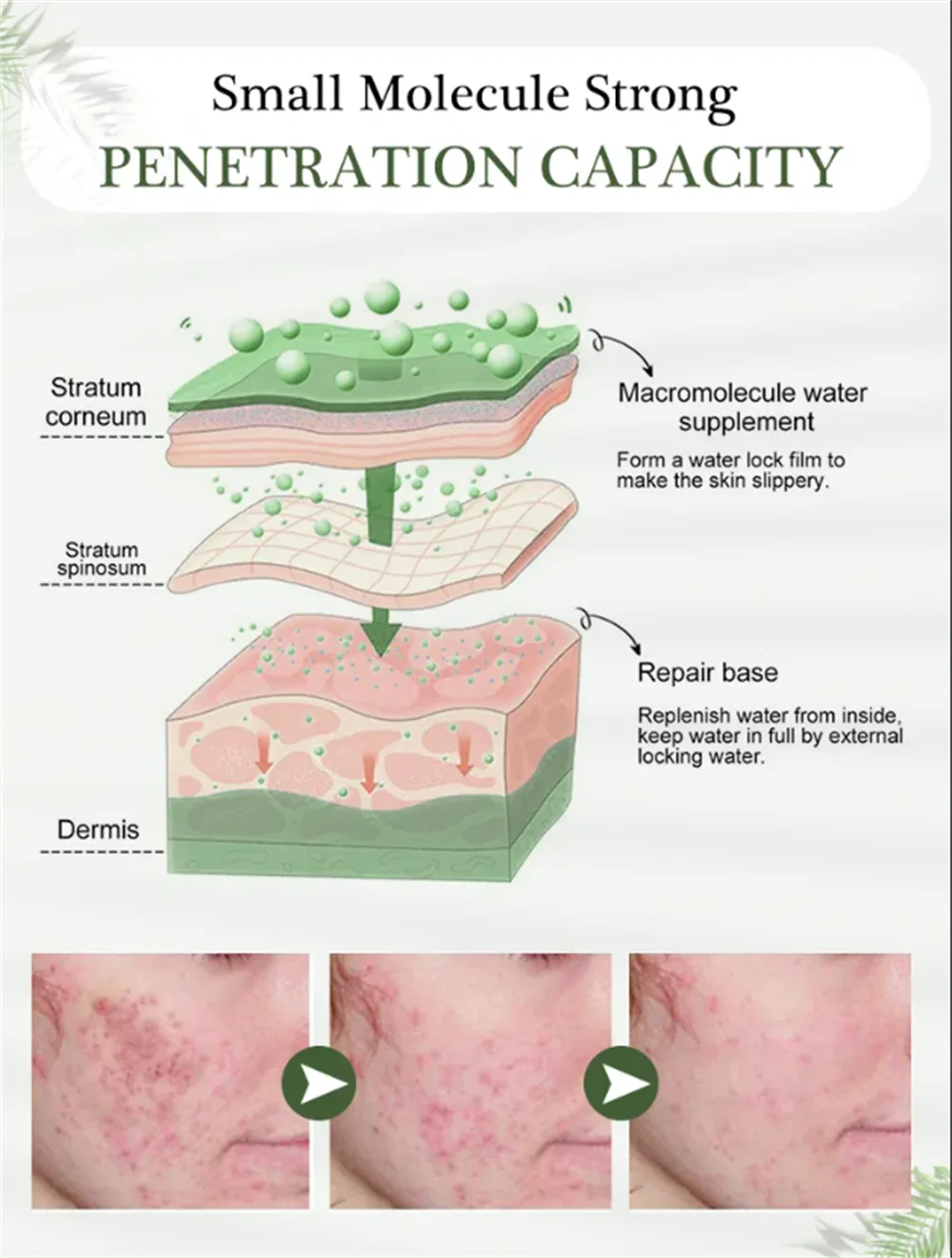 Salicylic Acid Acne Serum – Pore & Oil Control Treatment