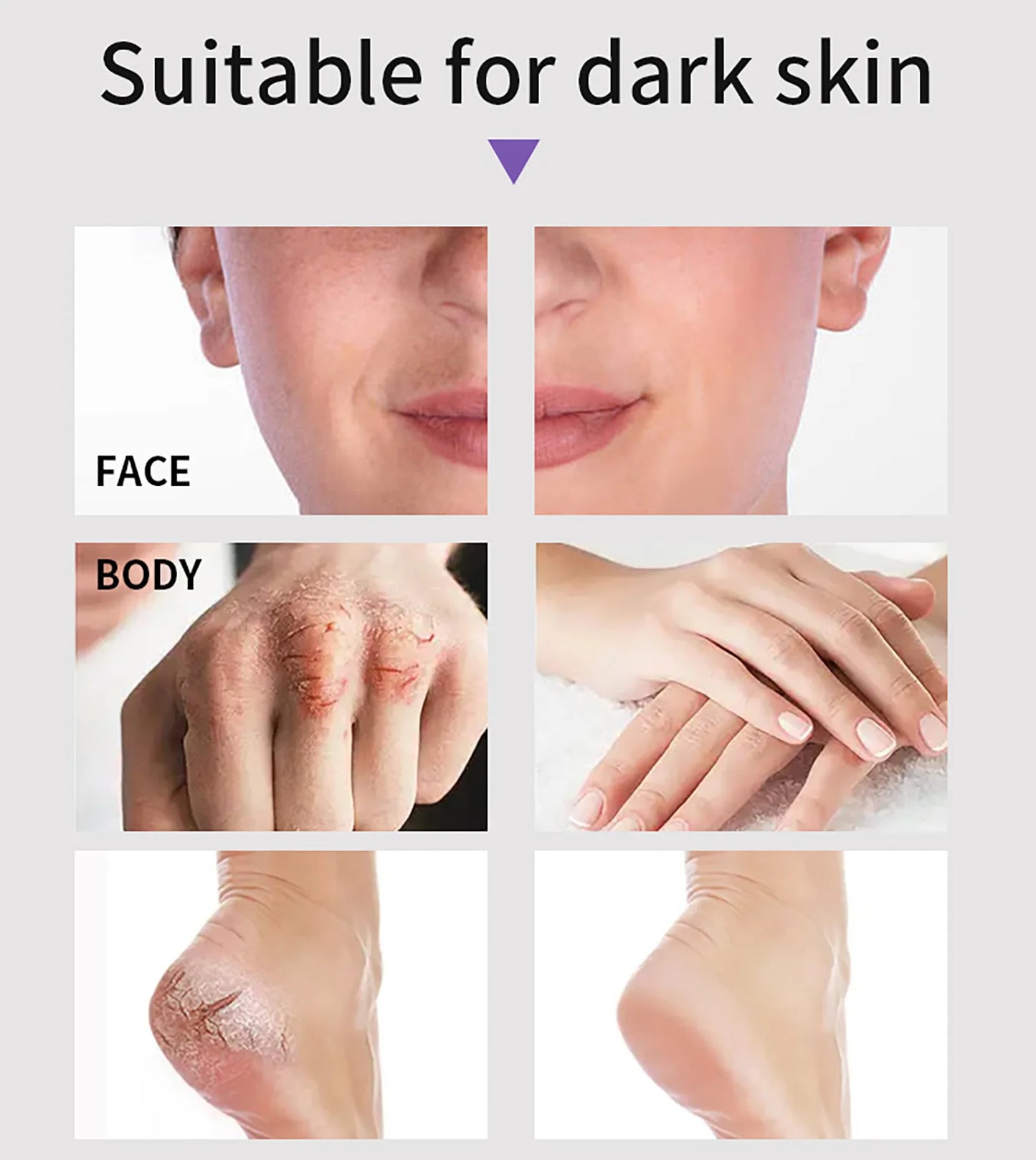 AILKE Bleaching Cream – Dark Spot Remover for Body & Face