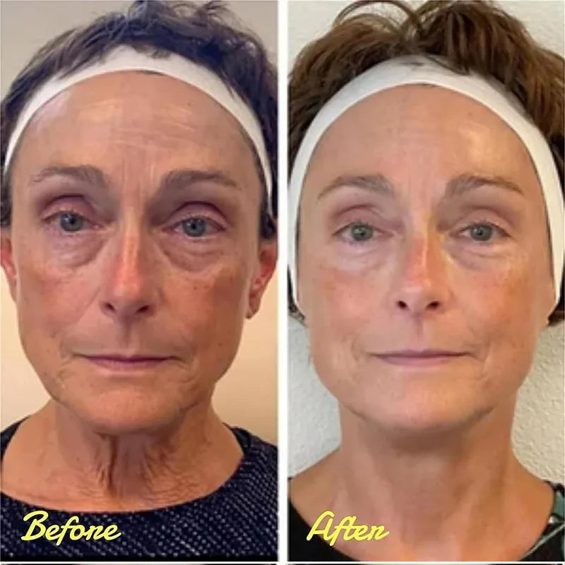 Eye Bag Removal Cream – Anti-Puffiness & Firming