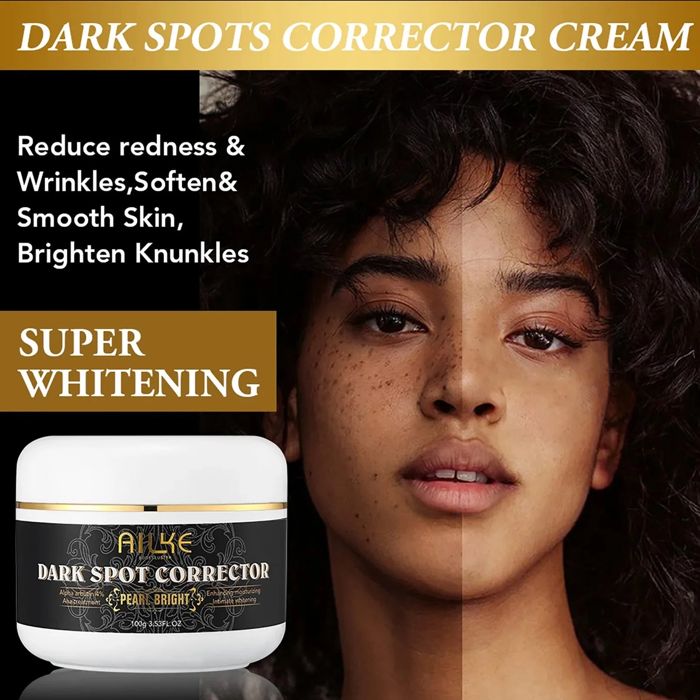 AILKE Bleaching Cream – Dark Spot Remover for Body & Face