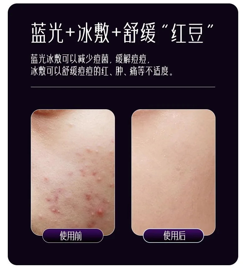 Multi-Function Beauty Device - EMS, Cryo Therapy & LED for Face Lifting & Rejuvenation