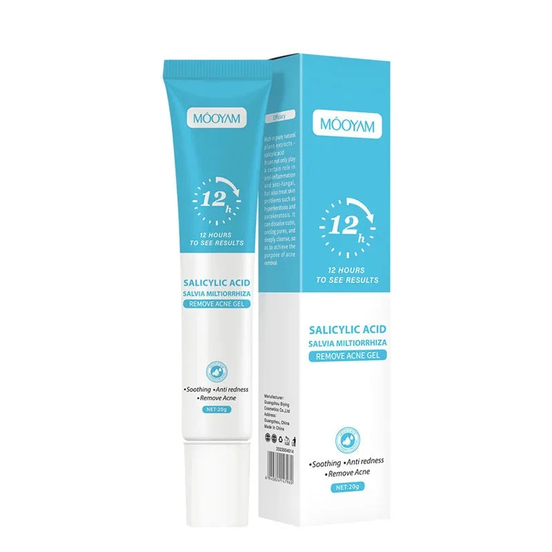 Acne Face Cream – Pimple Treatment & Oil Control Care