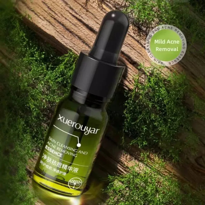 Salicylic Acid Acne Serum – Pore & Oil Control Treatment