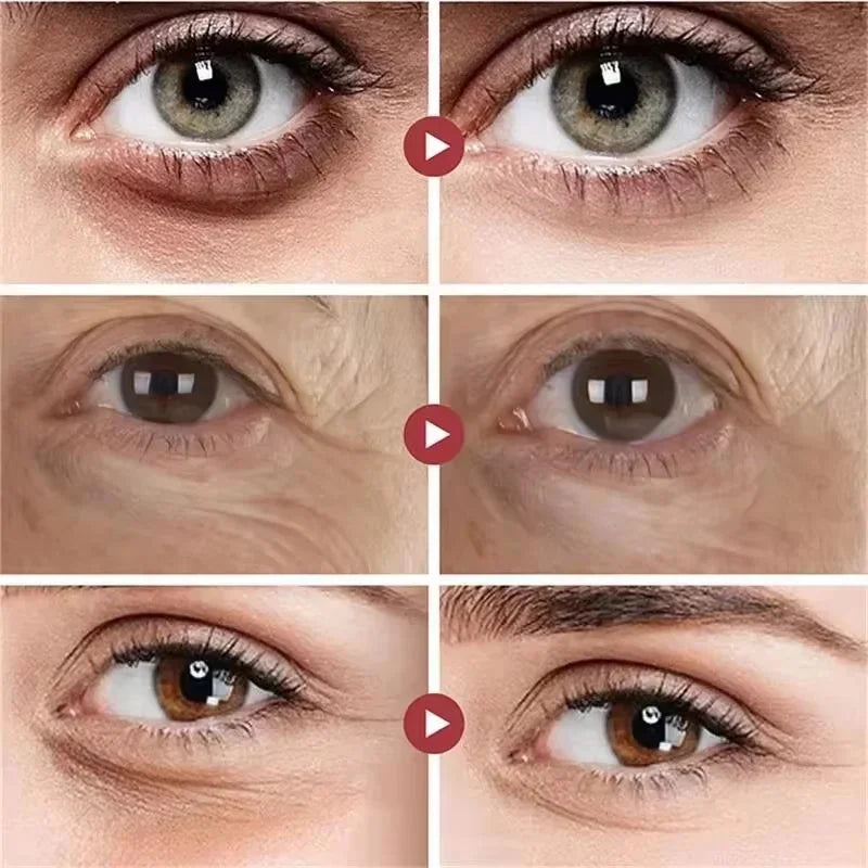Eye Bag Removal Cream – Anti-Puffiness & Firming