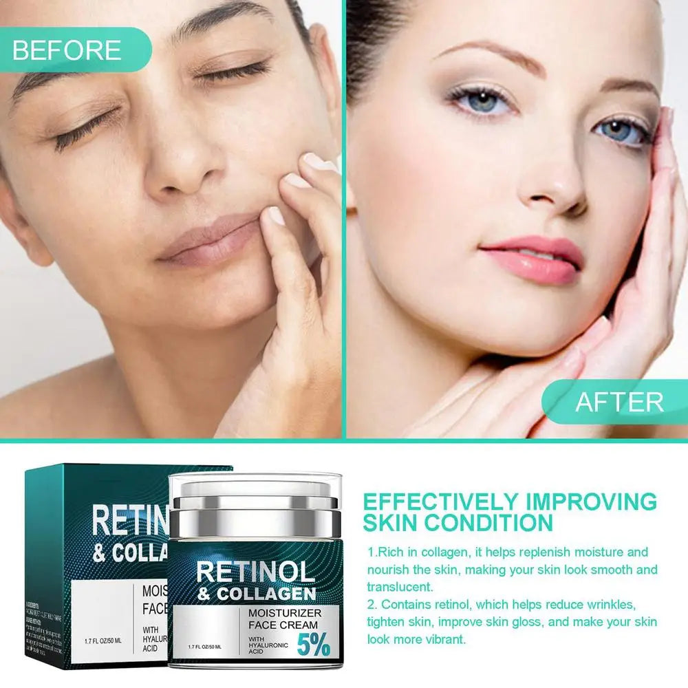 Retinol Anti-Aging Face Cream – Collagen & Hyaluronic Acid (50ml)